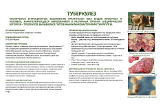 Туберкулез